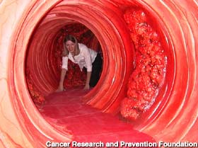 Kids love to take the mad scramble over polyps and other terrors of the colon.